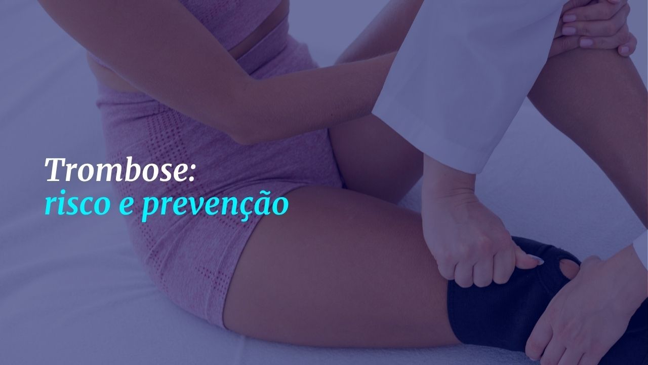  Pessoa ajustando meias de compressão para prevenir trombose venosa nas pernas